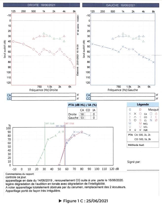 Figure 1C