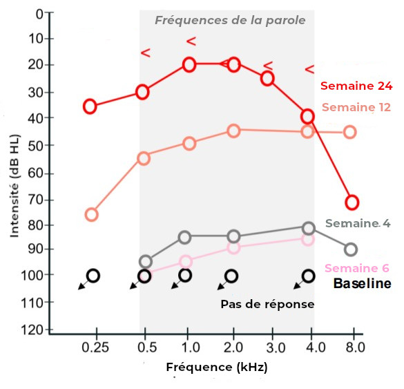 audiogramme regeneron