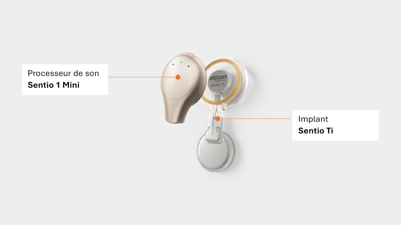 Oticon Medical S appr te Lancer Un Implant Conduction Osseuse Actif 