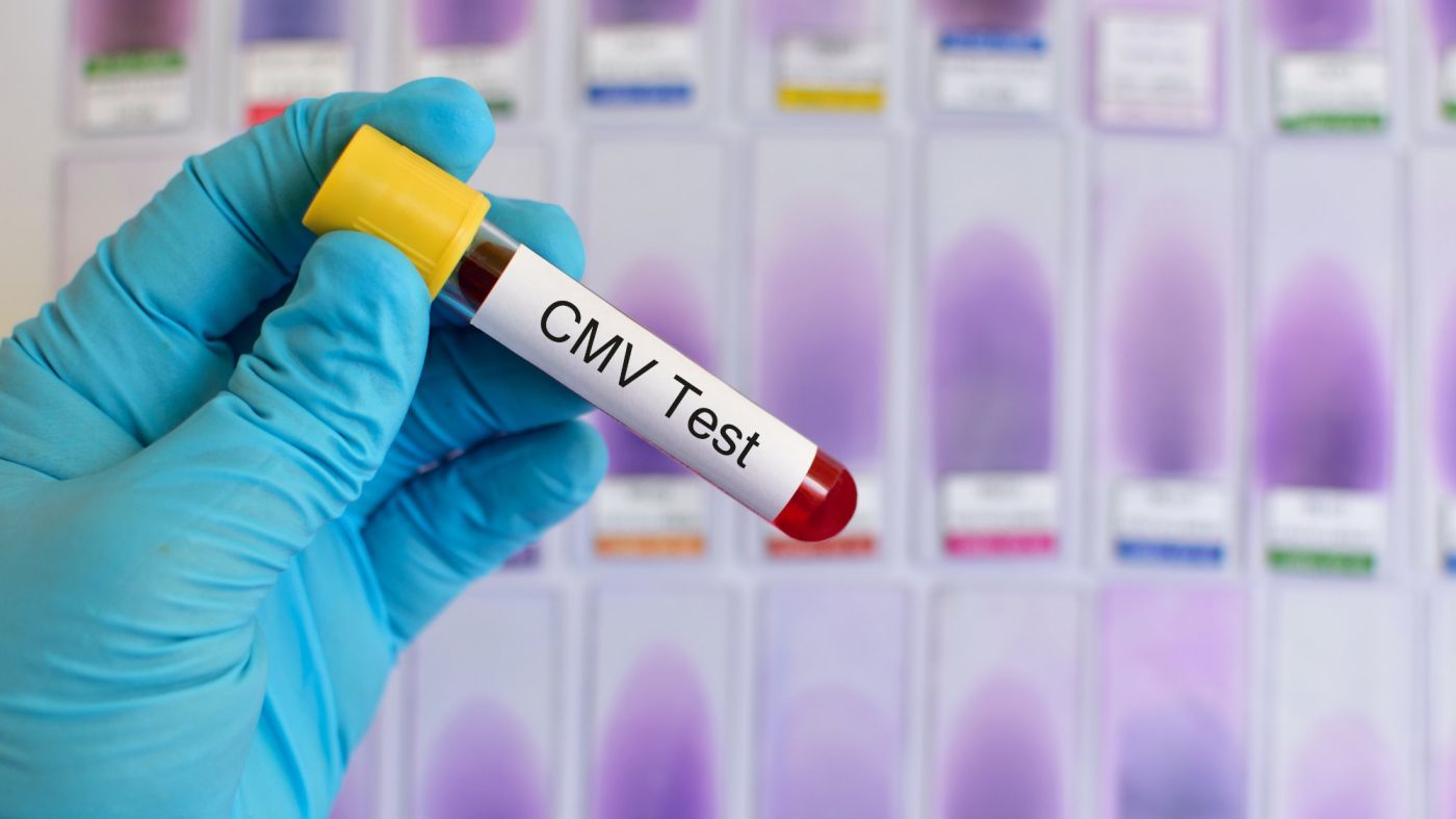 L’Académie de médecine plaide pour le dépistage systématique du CMV